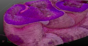 3Scan raises $14 million for a robotic microscope that could accelerate drug discovery