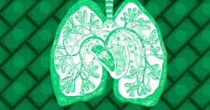 Kaggle hosting $1M competition to improve lung cancer detection with machine learning 