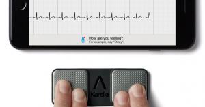 AliveCor unveils an AI stroke prevention platform, inks $30 million from Omron and the Mayo Clinic