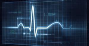 Sisense Pulse uses machine learning to trigger data anomaly alerts